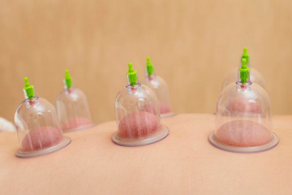 close up patient experiencing cupping therapy